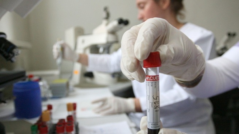Възможно ли е ключът към лечението на ХИВ да се крие в канабис